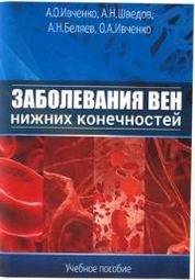 Заболевания вен нижних конечностей