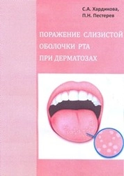 Поражение слизистой оболочки рта при дерматозах