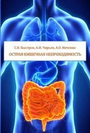 Острая кишечная непроходимость