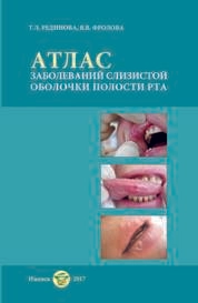 Атлас заболеваний слизистой оболочки полости рта