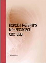 Пороки развития мочеполовой системы
