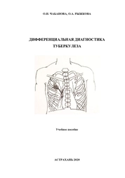 Дифференциальная диагностика туберкулеза