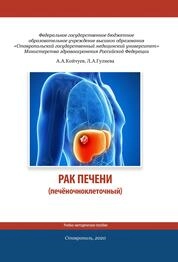 Рак печени (печёночноклеточный)