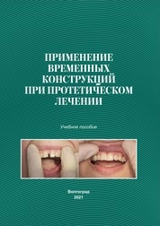Применение временных конструкций при протетическом лечении