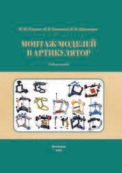 Монтаж моделей в артикулятор