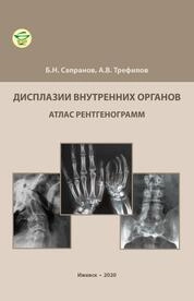 Дисплазии внутренних органов: атлас рентгенограмм