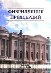 Фибрилляция предсердий
