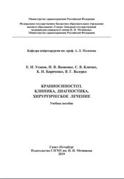 Краниосиностоз. Клиника, диагностика, хирургическое лечение