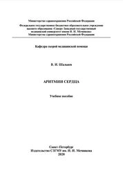 Аритмии сердца