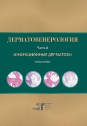 Дерматовенерология. Ч. 2. Инфекционные дерматозы