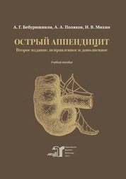 Острый аппендицит