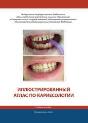 Иллюстрированный атлас по кариесологии