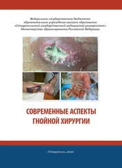 Современные аспекты гнойной хирургии