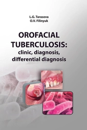 Orofacial tuberculosis: clinic, diagnosis, differential diagnosis: tutorial