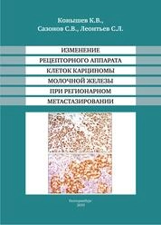 Изменение рецепторного аппарата клеток карциномы молочной железы при регионарном метастазировании