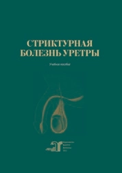 Стриктурная болезнь уретры