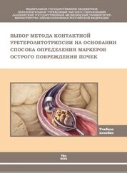 Выбор метода контактной уретеролитотрипсии на основании способа определения маркеров острого повреждения почек