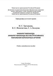 Инфаркт миокарда: инфаркт миокарда без обструктивного поражения коронарных артерий