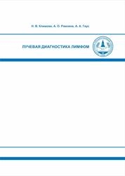 Лучевая диагностика лимфом