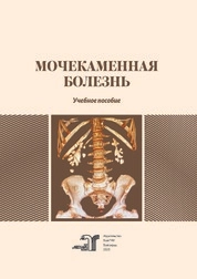 Мочекаменная болезнь