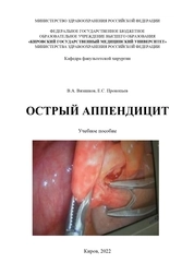 Острый аппендицит