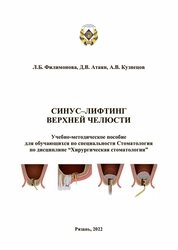 Синус-лифтинг верхней челюсти