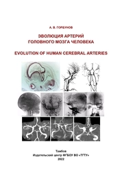 Эволюция артерий головного мозга человека