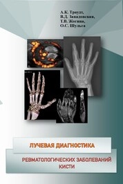 Лучевая диагностика ревматологических заболеваний кисти