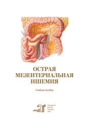 Острая мезентериальная ишемия