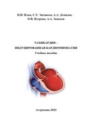 Тахикардия – индуцированная кардиомиопатия