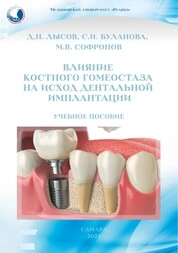 Влияние костного гомеостаза на исход дентальной имплантации