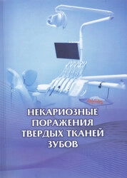 Некариозные поражения твердых тканей зубов
