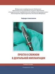 Просто о сложном в дентальной имплантации