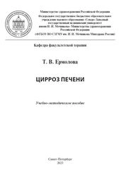 Цирроз печени