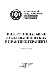 Интерстициальные заболевания легких в практике терапевта