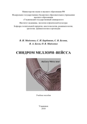 Синдром Меллори-Вейсса