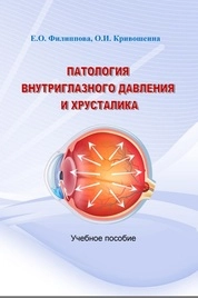 Патология внутриглазного давления и хрусталика