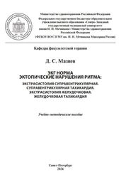 ЭКГ норма. Эктопические нарушения ритма: Экстрасистолия суправентрикулярная. Суправентрикулярная тахикардия. Экстрасистолия желудочковая. Желудочковая тахикардия