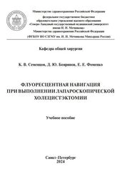 Флуоресцентная навигация при выполнении лапароскопической холецистэктомии