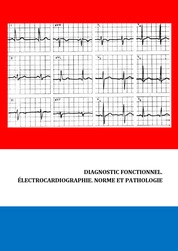 Diagnostic fonctionnel: électrocardiographie. Norme et pathologie