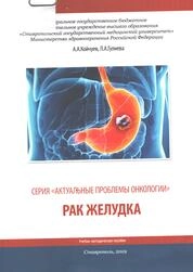 Рак желудка